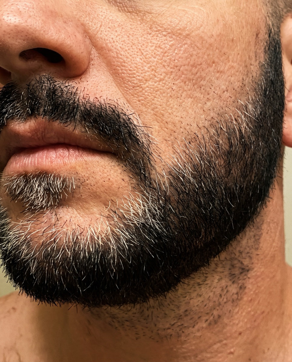 Dyed black beard with white regrowth showing at the roots